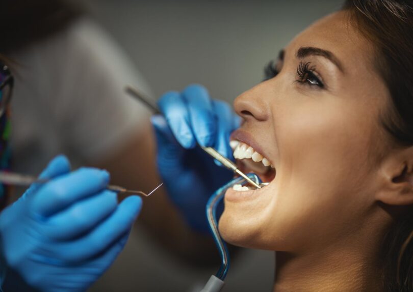 Composite bonding in York