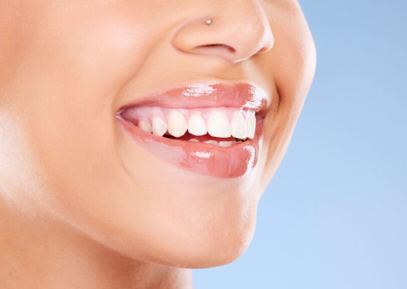 Invisalign in York