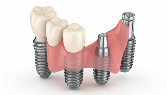 York dental